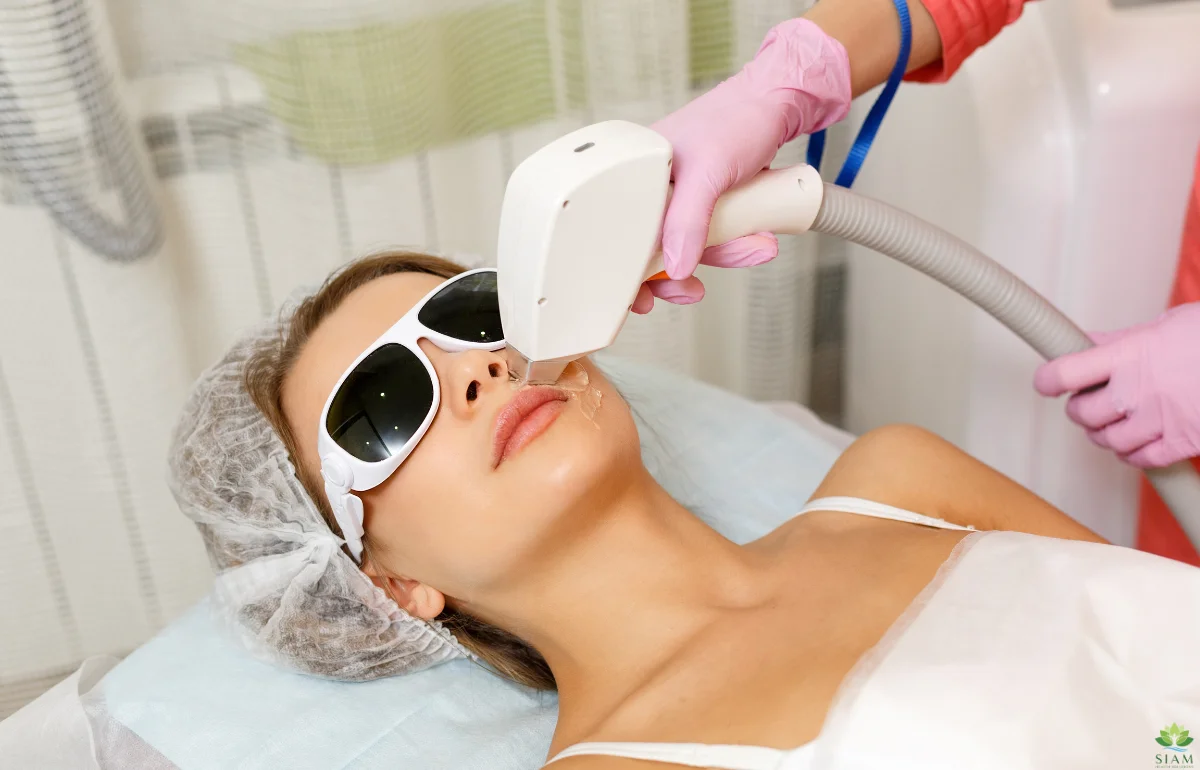 A woman receiving a laser hair removal treatment on her upper lip in a professional clinic. The procedure is being performed with a modern laser device, ensuring precision and comfort.